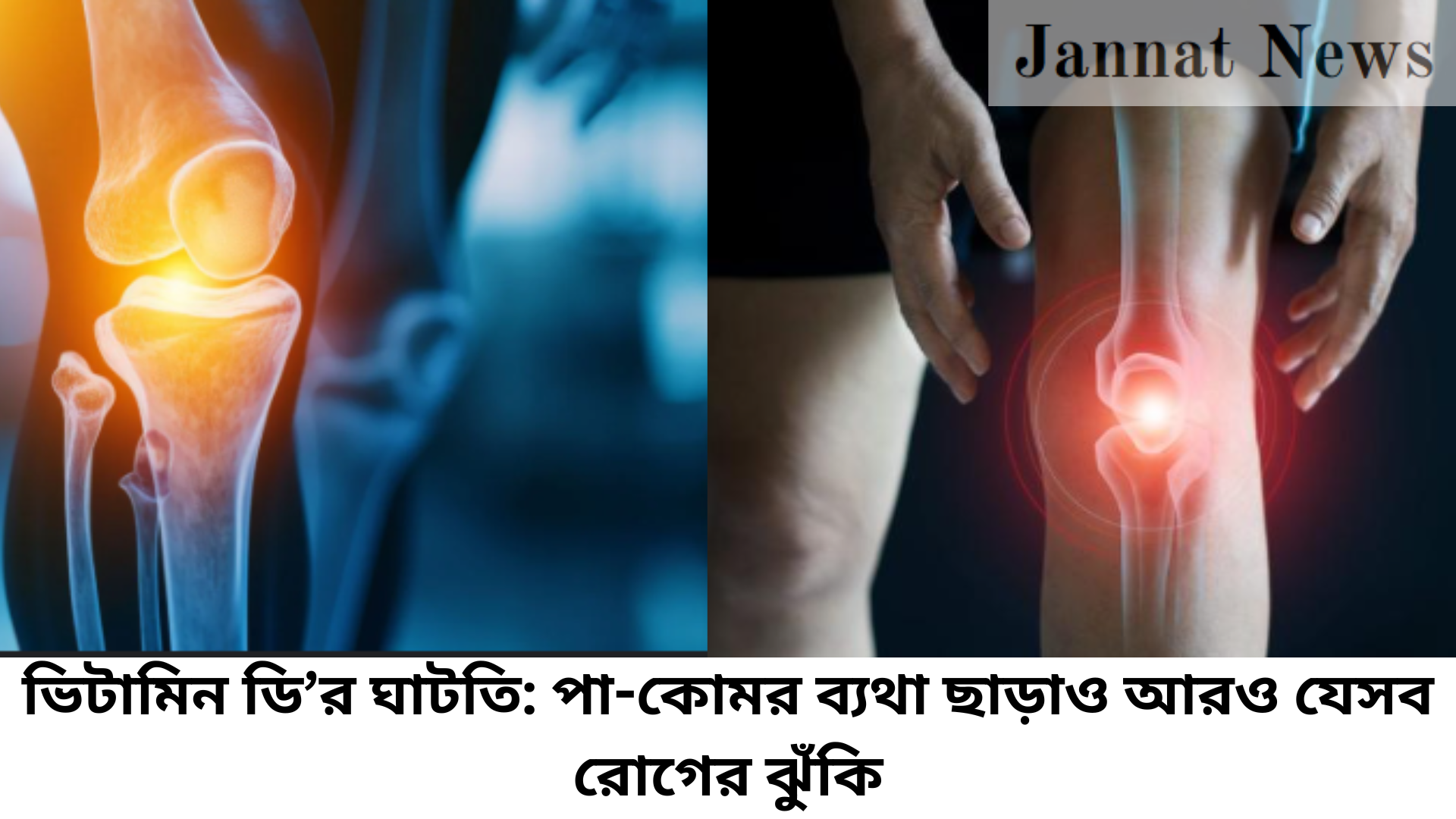 ভিটামিন ডি’র ঘাটতি: পা-কোমর ব্যথা ছাড়াও আরও যেসব রোগের ঝুঁকি