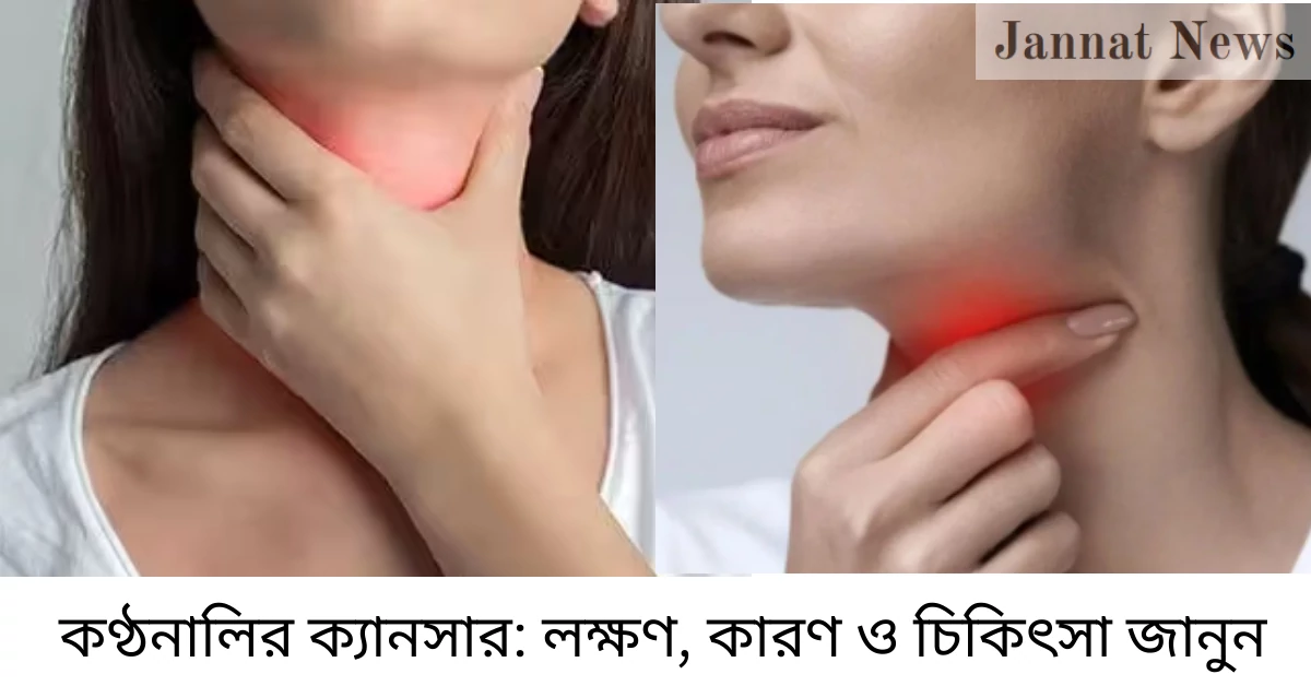 কণ্ঠনালির ক্যানসার: লক্ষণ, কারণ ও চিকিৎসা জানুন