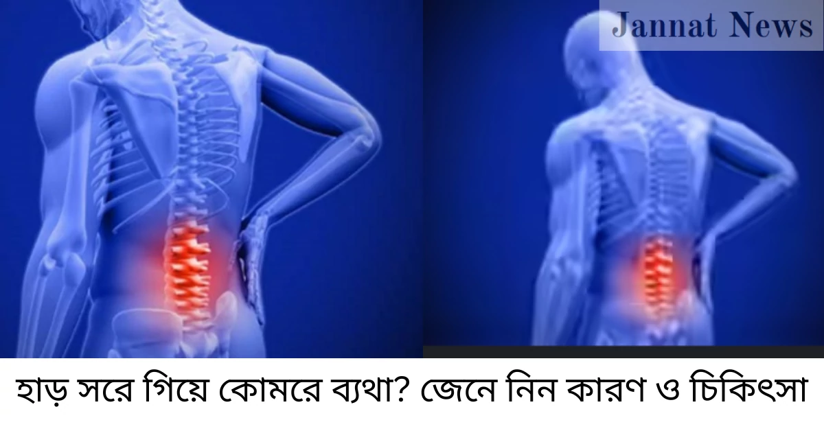 হাড় সরে গিয়ে কোমরে ব্যথা? জেনে নিন কারণ ও চিকিৎসা
