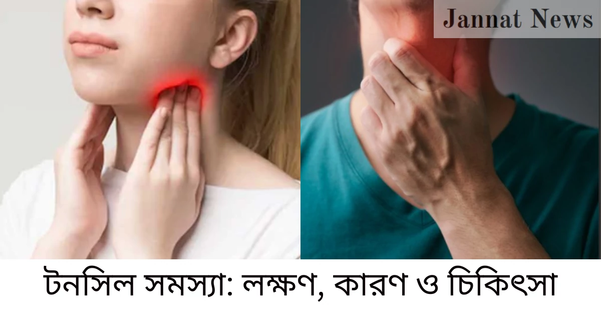 টনসিল সমস্যা: লক্ষণ, কারণ ও চিকিৎসা
