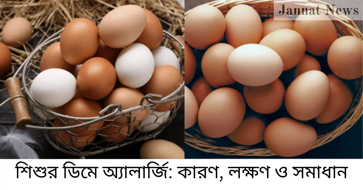 শিশুর ডিমে অ্যালার্জি: কারণ, লক্ষণ ও সমাধান