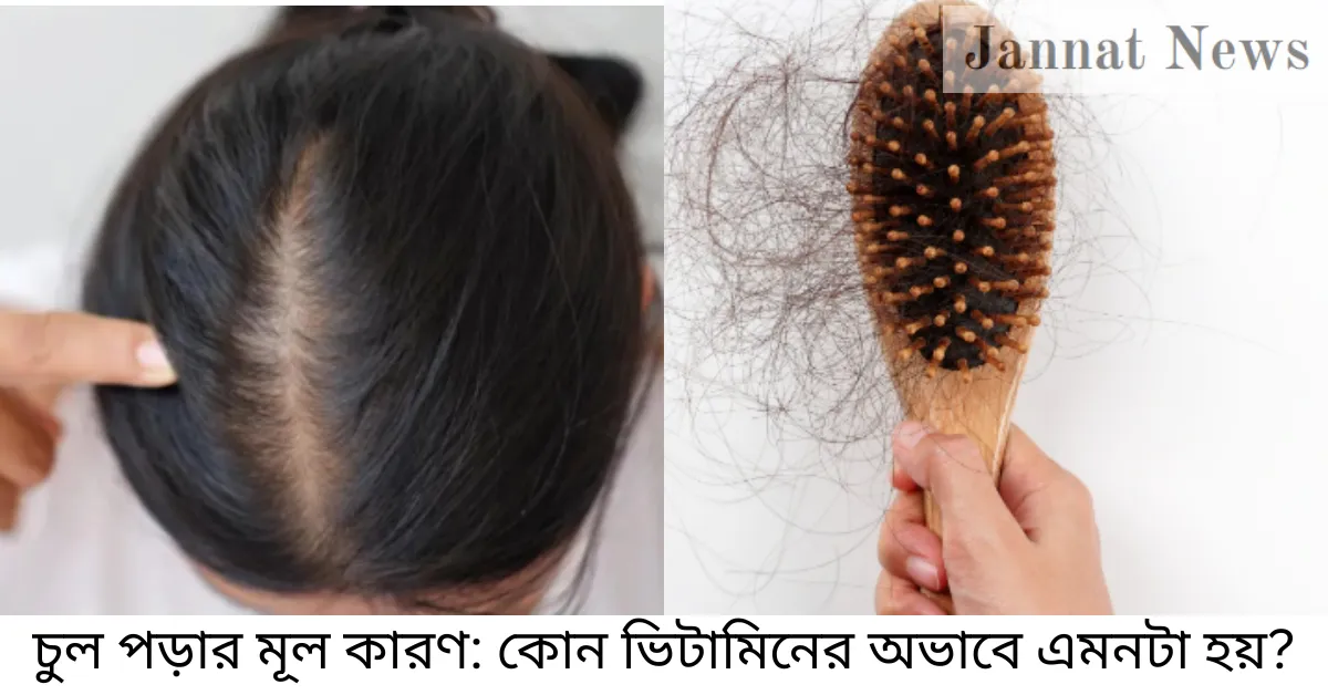 চুল পড়ার মূল কারণ: কোন ভিটামিনের অভাবে এমনটা হয়?